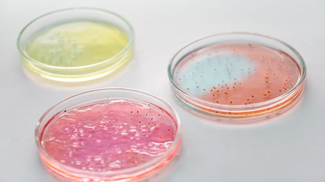 Microbiota intestinale, vitamina D e tumori